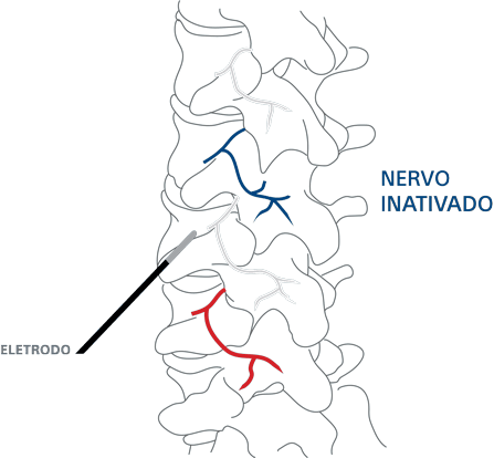 Nervos 2
